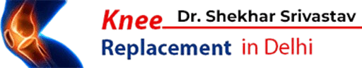 Knee Replacement Delhi
